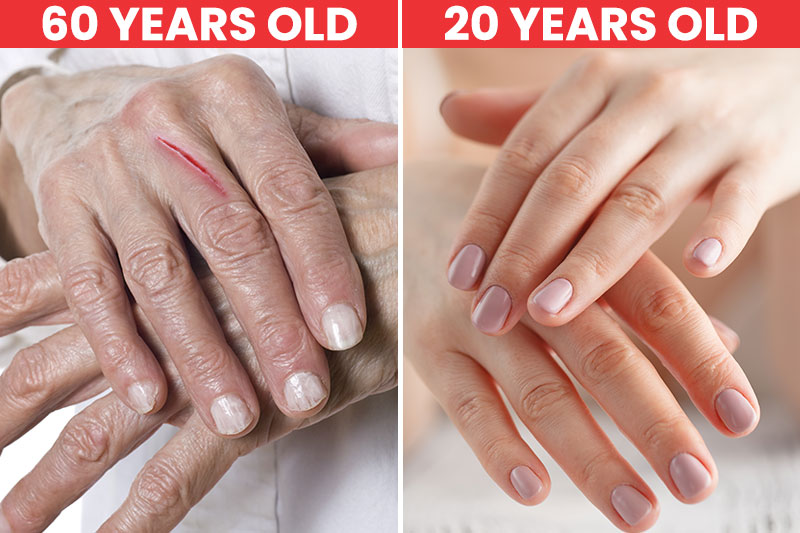 10 Unexpected Signs Show Aging Even Before You Develop Wrinkles6