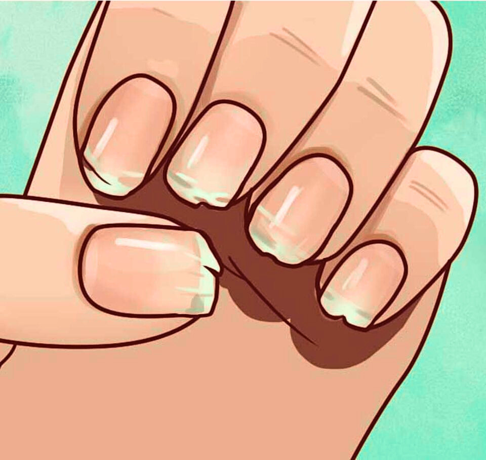 Are Your Nails Always Splitting Or Breaking Heres What Your Body Is Trying To Tell You3 e1725732373770