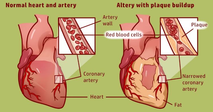 With Just One Celery Stalk These Are The Effects On Your Bones And Heart12