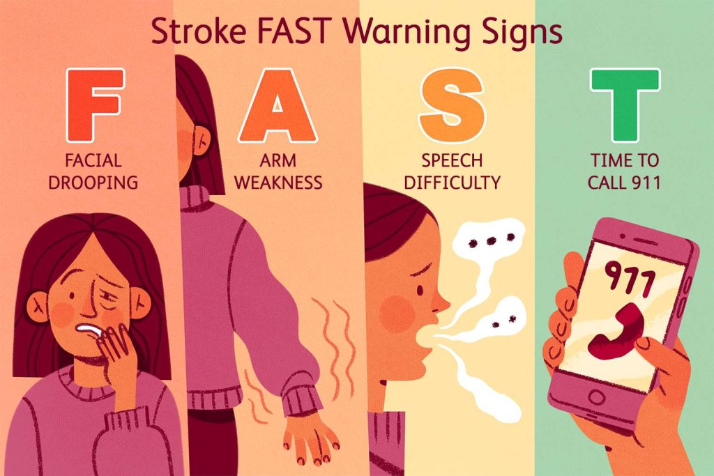 what to do stroke 5210696 Final 3f02e00a33c6439c803af4a58ae8d12c 1024x683 1