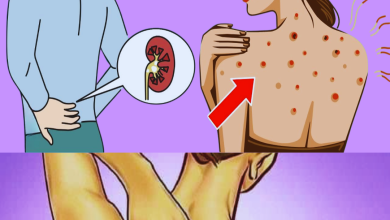 10 signs that your kidneys are failing and crying for help