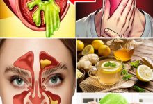 4 Effective Home Remedies to Eliminate Mucus2 scaled 1