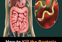 How to Kill the Bacteria Causing Heartburn and Bloating