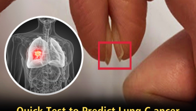 This simple fingernail test could help save your life